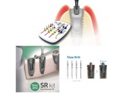 Screw Remover Kit (Sada pro odstranění zlomeného šroubu)